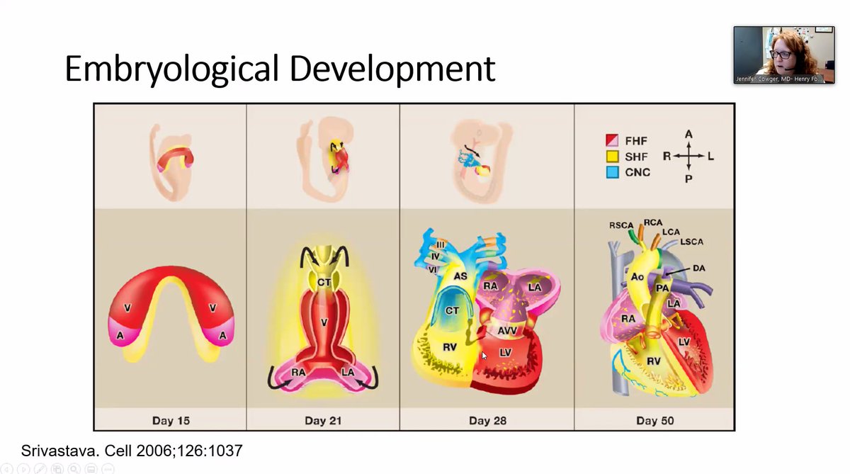 Embryological development of the RV. Dr. Cowger  @preventfailure is back to the basics!!! RV/LV exposed to different signals during development. Diff transcription factors impact RV/LV development. This leads to difft distribution of receptors/response to pharmacological agents.