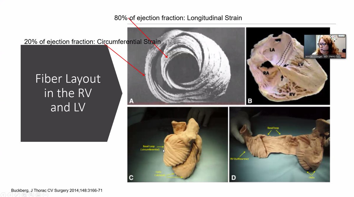 RV and LV fiber morphology differs. "The septum is a helix, but in the RV they are longitudinal."  @preventfailure (I think I got this right...).