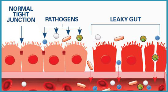 With a slowed thyroid comes a slowed metabolismThis leads to:- digestion issues- constipation- leaky gut- poor detoxification- weight gain- hair loss, etc.