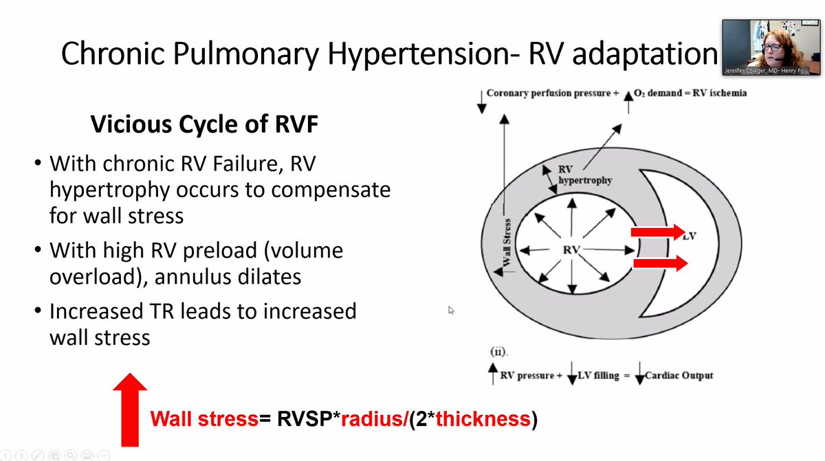Processes of remodeling in chronic pulmonary hypertension.  @preventfailure (I wish I could capture the fascinating stuff Jennifer is saying...!)
