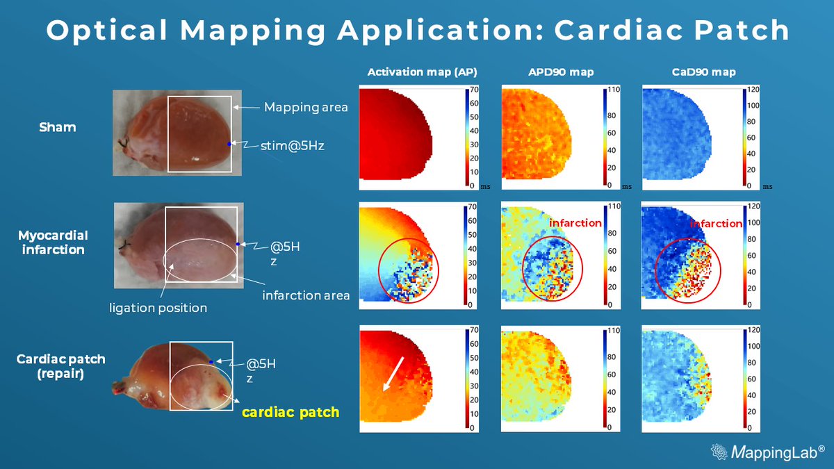 MappingLab_EP's tweet image. Optical Mapping System can be an excellent tool for cardiac patch studies, particularly in assessing the outcome of cardiac repair at the tissue/organ level.

#cardiotwitter #opticalmapping  #research #regeneration #electrophysiology