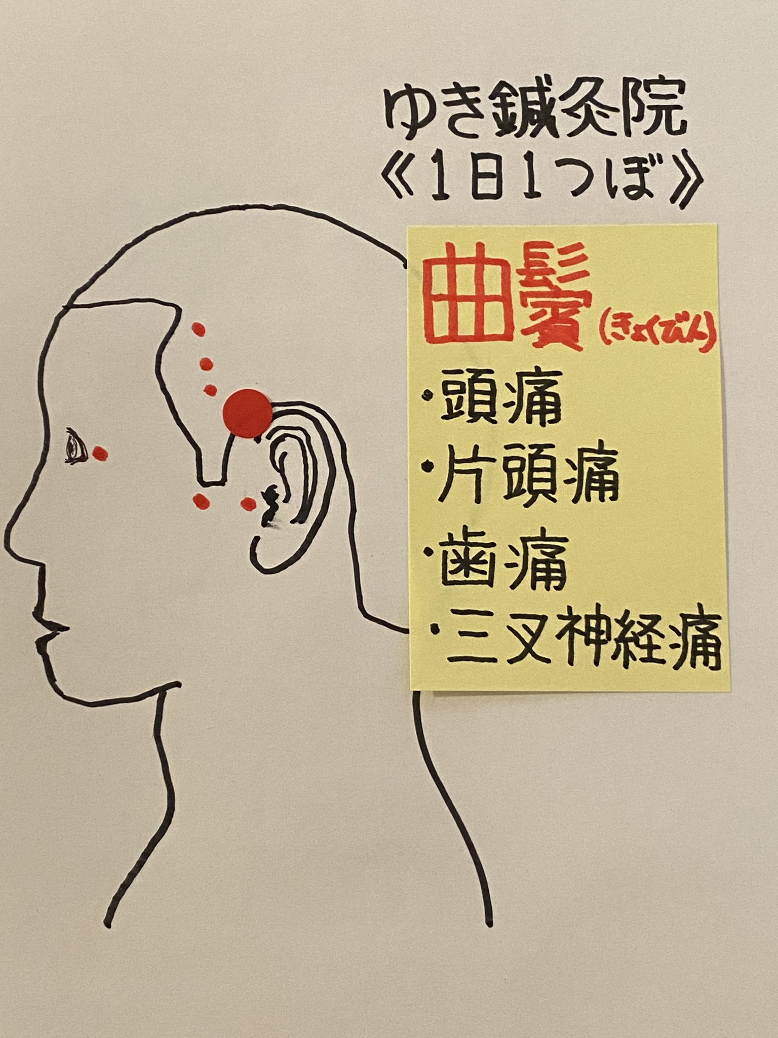 小林 拓矢 鍼灸師 On Twitter １日１ツボ 曲鬢 Gb07 足の少陽胆経 The Gallbladder Meridian 耳鳴り 難聴 めまい 視力減退 頭痛 歯痛など 筋肉 側頭頭頂筋 側頭筋 神経 運動神経 顔面神経 三叉神経 知覚神経 耳介側頭神経 血管
