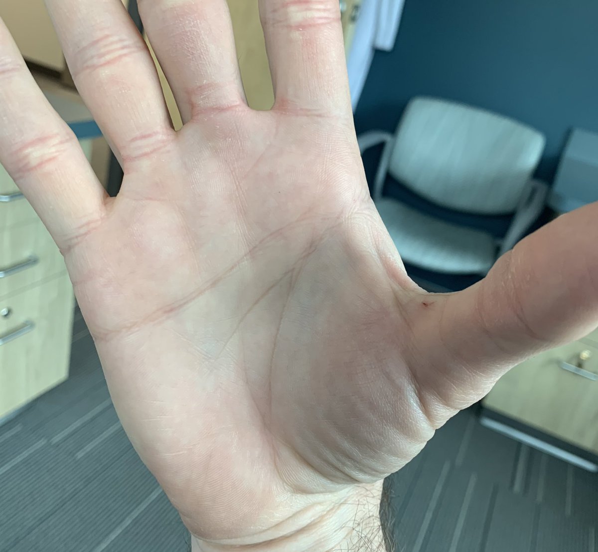 Dr. Glaucomflecken tweet media