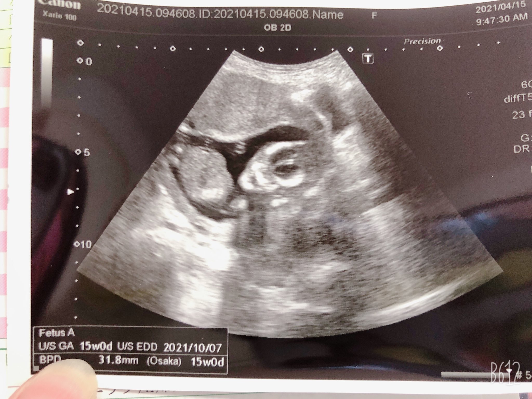 エコー動画 Twitter Search Twitter