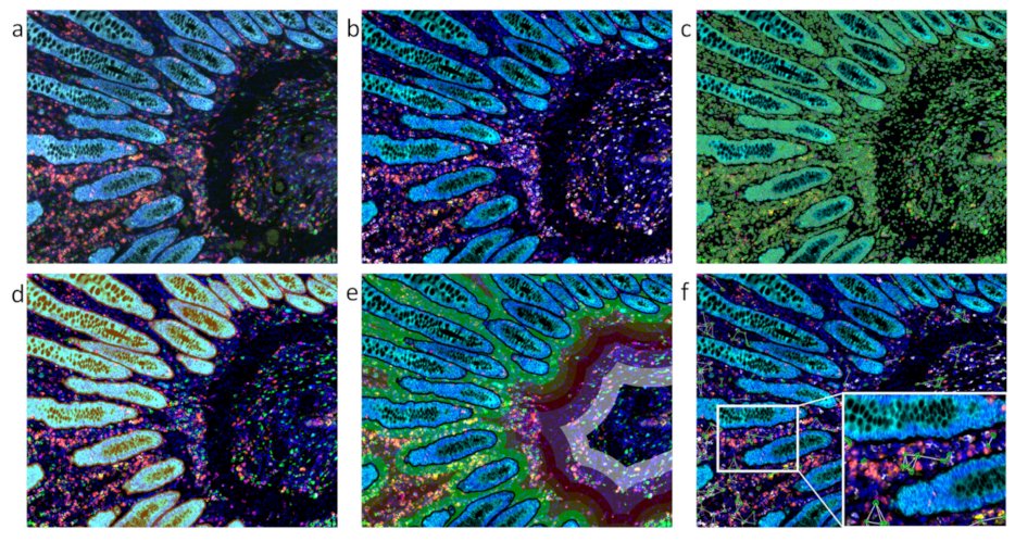 Check out our recent publication based on Next-Generation Digital Histopathology of the Tumor Microenvironment.
doi.org/10.3390/genes1…
<a href="/TRI_info/">Translational Research Institute</a> <a href="/QUT/">QUT</a> @qut_ihbi <a href="/jyotsnabatra/">Prof Jyotsna Batra</a> <a href="/TGRupert/">Rupert Ecker</a>
