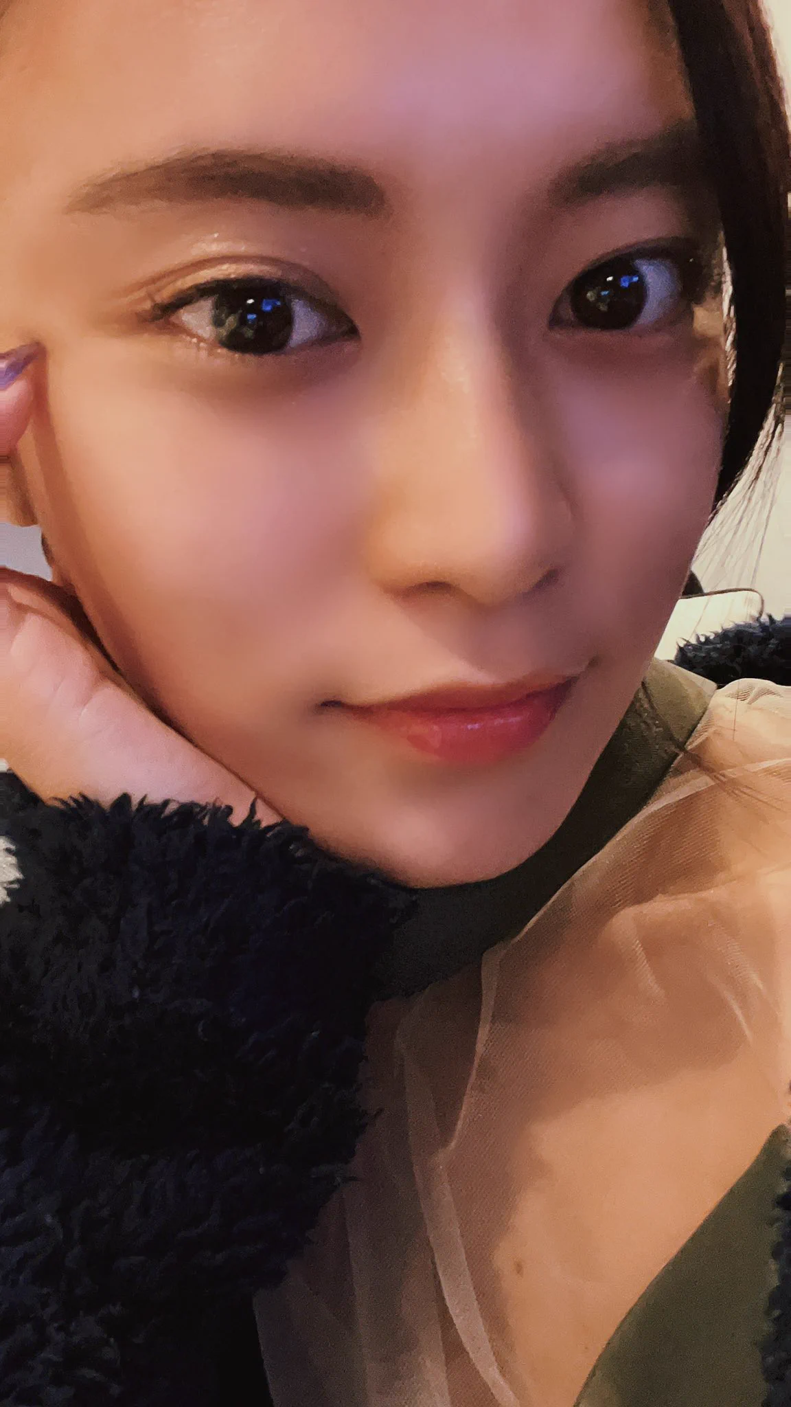 小島瑠璃子さんが親知らずを2本抜歯した結果がこちらｗｗｗ