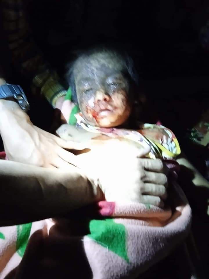 SuThinzarHtet7's tweet photo. Tw // violence
On April 4, the KIA 5th brigade has been attacked by Myanmar Military with grenades thrown from jets. Many villagers including very young kids has been injured.
Speak out for #kachin
#WhatsHappeningInMyanmar
#Apr8Coup https://t.co/3dyTj6vbnk