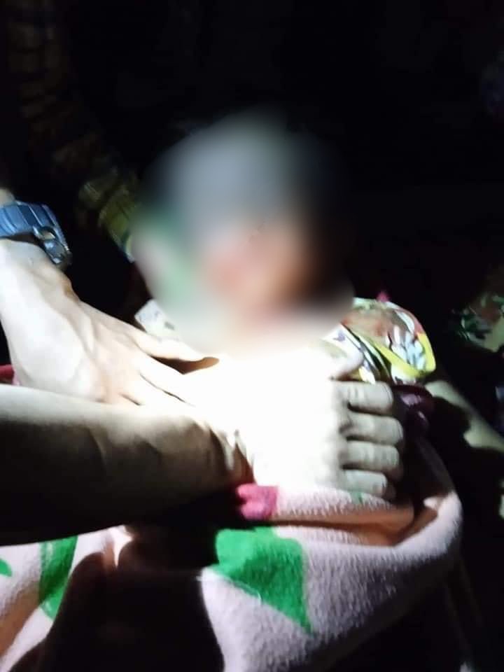nslwin's tweet photo. Brigade 5, Karen National Union (KNU) area:

Many villagers including young children were injured in air strikes by Terrorists (#Myanmar military) on Apr 4. 

#WhatsHappeninglnMyanmar #Apr8Coup https://t.co/JxrDShIyta