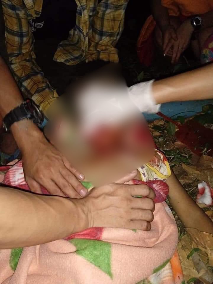 nslwin's tweet photo. Brigade 5, Karen National Union (KNU) area:

Many villagers including young children were injured in air strikes by Terrorists (#Myanmar military) on Apr 4. 

#WhatsHappeninglnMyanmar #Apr8Coup https://t.co/JxrDShIyta