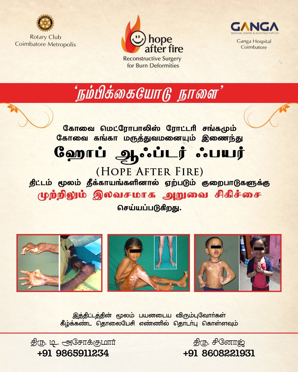Karthi_Offl's tweet photo. Coimbatore Ganga Hospital and Rotary Club Coimbatore Metropolis jointly have been treating people affected by fire accidents, for past 10years. https://t.co/NF1MpB9sQF