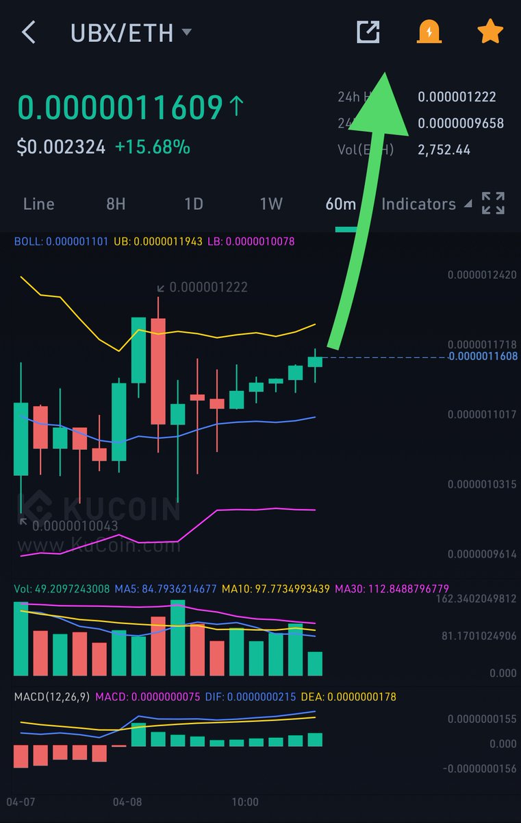 Cryptos01004649's tweet photo. $UBX 60 minute chart looking beautiful! https://t.co/rYzLx1LbpD