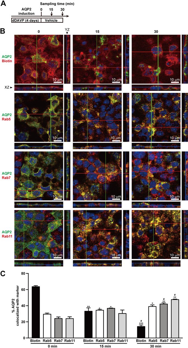 AJPRenal's tweet photo. #ImageOfTheWeek: Fig. 1 "Aquaporin-2 (#AQP2) returns to recycling endosomes by way of early endosomes upon vasopressin withdrawal."
By: Wei-Ling Wang, et al.
Read full article here: https://t.co/P5sWAAMrN8
#AJPRenal #Rab7 #Vasopressin @iloventu https://t.co/Cmn4uP2O2w