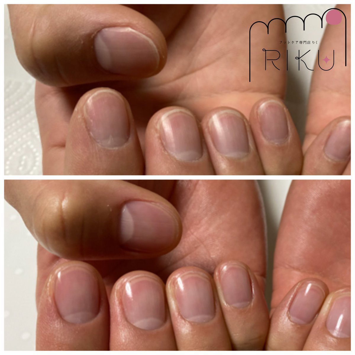フットケア専門店りく 袖ヶ浦店 メンズネイルケアのビフォーアフターです 指先を整えるだけで好印象 清潔感アップ 書類を渡す時 名刺交換 指先が綺麗だと相手に与える印象が違います 男性のネイルケアは身だしなみの一つです 袖ヶ浦