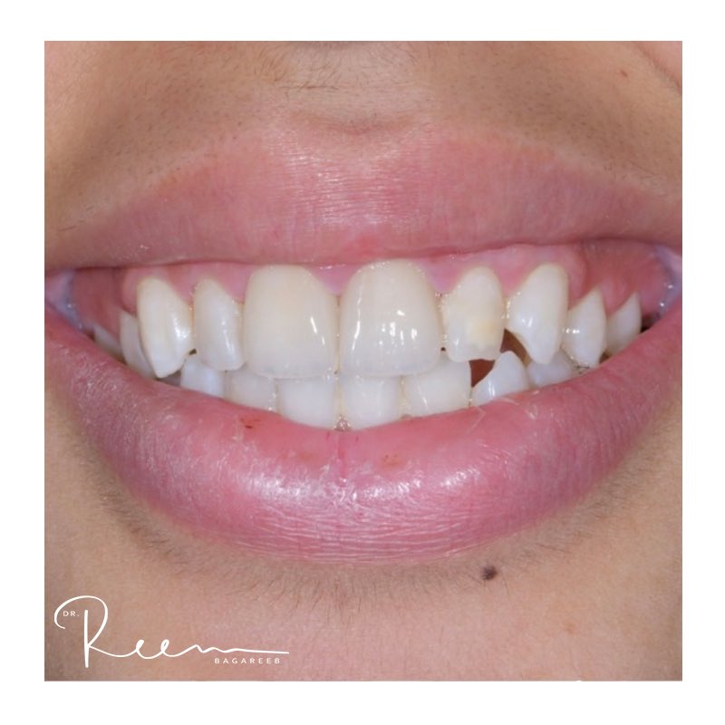ReemRm1992's tweet photo. Digital from A to Z 😍 @dentiscope https://t.co/tcOTpJFGRA