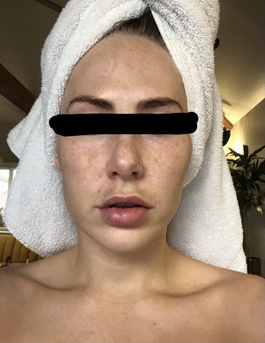 been taking pics of my bare skin since i started a new routine in january (bc sometimes it&rsquo;s hard to