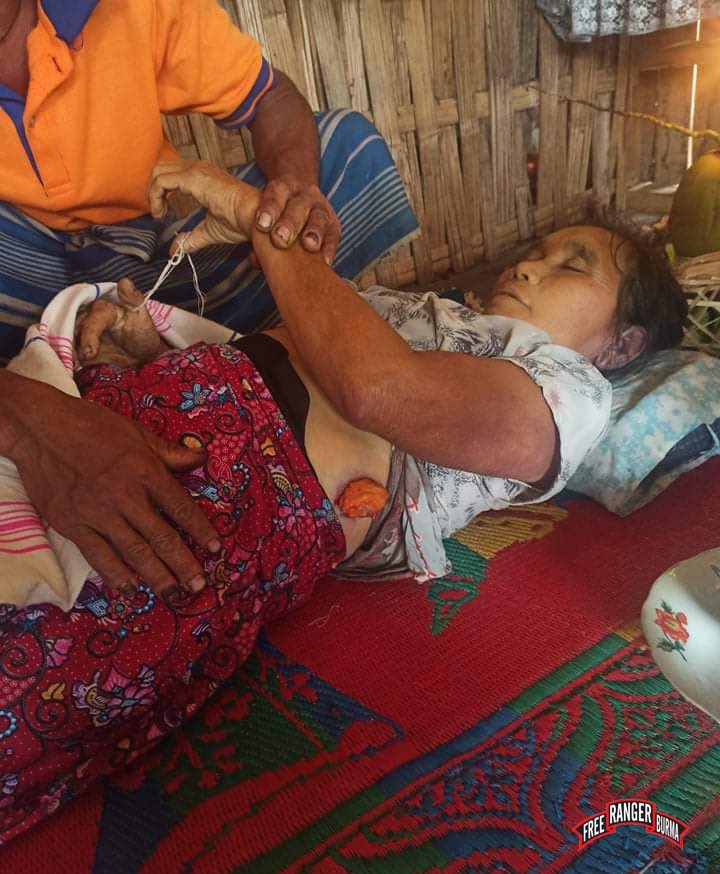 On 2 April 2021, at 19:20, Burma Army MOC 8, LIB 408, shot three mortars into Ler Day Kaw Village in Butho Township, Mutraw District. One round impacted and killed 55-year-old Naw Mu Toh and wounded her husband, Saw Mya Aung, age 56. She leaves behind her husband and 6 children.