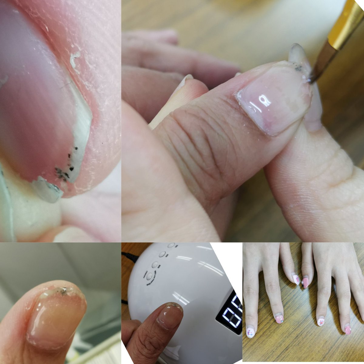 我が子to苦もん 主婦あるあるかと思うのですが 爪割れませんか 私はよく包丁で爪を破損します 若いスタッフちゃんが ジェルネイル上手で ジェルネイルで怪我爪を治してくれました 春休み中は娘の爪も可愛くしてくれていました ネイル屋さんで爪破損 治し
