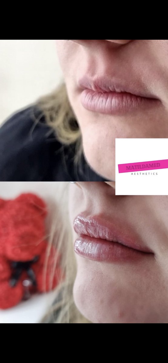 Jay&Sketch❤️ tweet media