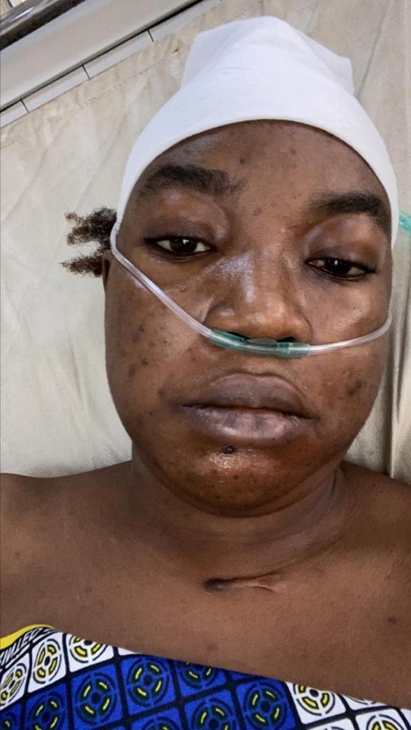 Please help save Arinola, she has been diagnosed with blood cancer (acute myeloid leukemia) she is currently battling for her life. Help with a retweet if you can't donate gofundme.com/f/help-arinola…