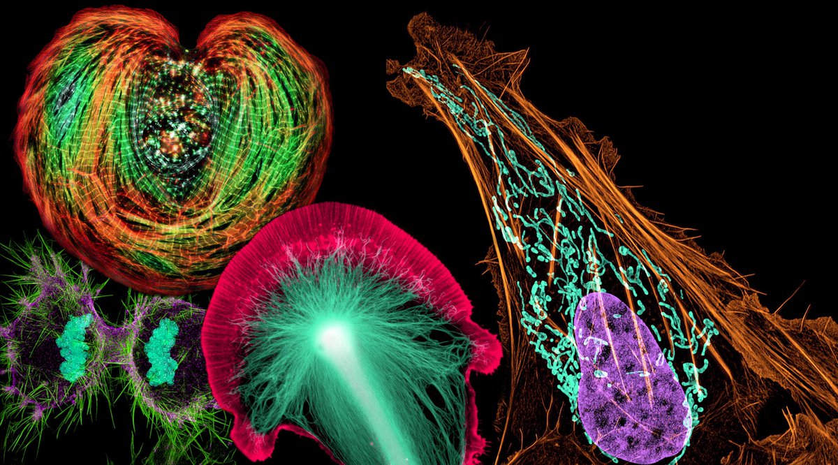MAG2ART's tweet photo. Cells photographed through a microscope displayed using nontraditional color combinations.
#CellBiology #microscopy #SciArt https://t.co/gnY7JlfoVf