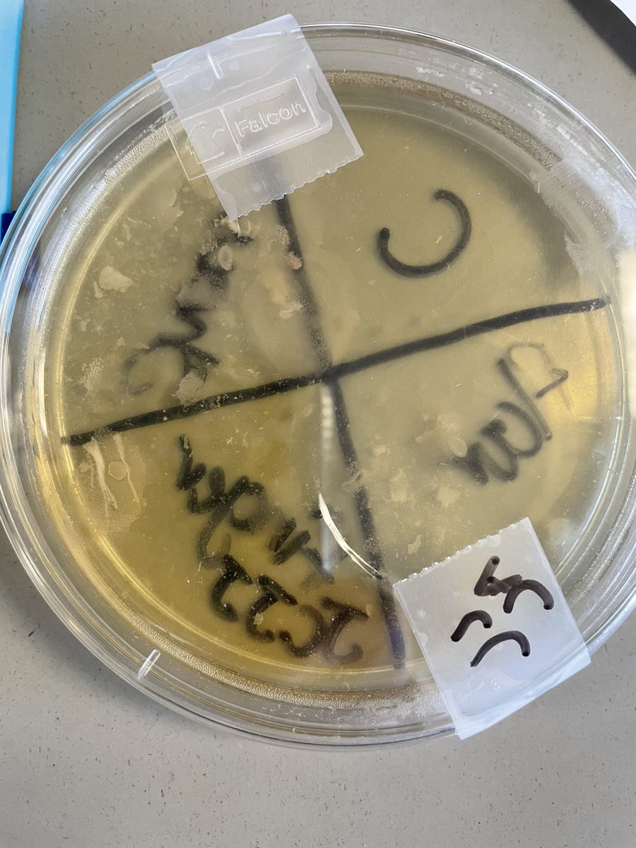 How do biohazards effect human health? We swabbed surfaces around the room to see how clean things really are. #envirosci