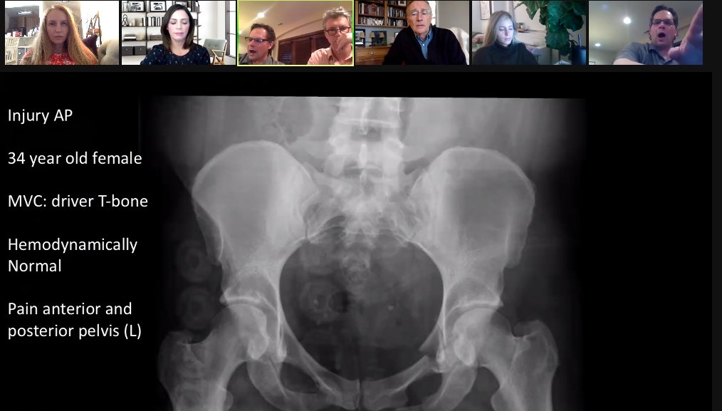 Yelena Bogdan, MD, FACS, FAAOS (@invictaortho) on Twitter photo Great webinar sponsored by <a href="/Stryker_TE/">Trauma & Extremities</a> on pelvis tonight, featuring master surgeon Dr. Templeman of <a href="/HennepinHC/">Hennepin Healthcare</a>, past OTA president & a friend. My advice to residents--continually seek out self-improvement events in your specialty, at least once a week: webinars, journals, etc. Great webinar sponsored by <a href="/Stryker_TE/">Trauma & Extremities</a> on pelvis tonight, featuring master surgeon Dr. Templeman of <a href="/HennepinHC/">Hennepin Healthcare</a>, past OTA president & a friend. My advice to residents--continually seek out self-improvement events in your specialty, at least once a week: webinars, journals, etc.