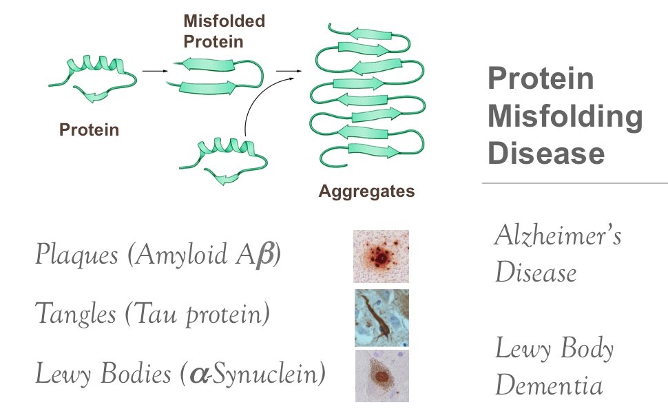 The biochemistry of Alzheimer's disease, the most common cause of dementia, is not yet very well understood. It has been identified as a protein misfolding disease due to the accumulation of abnormally folded amyloid beta proteins. We’re still learning about it. 12/