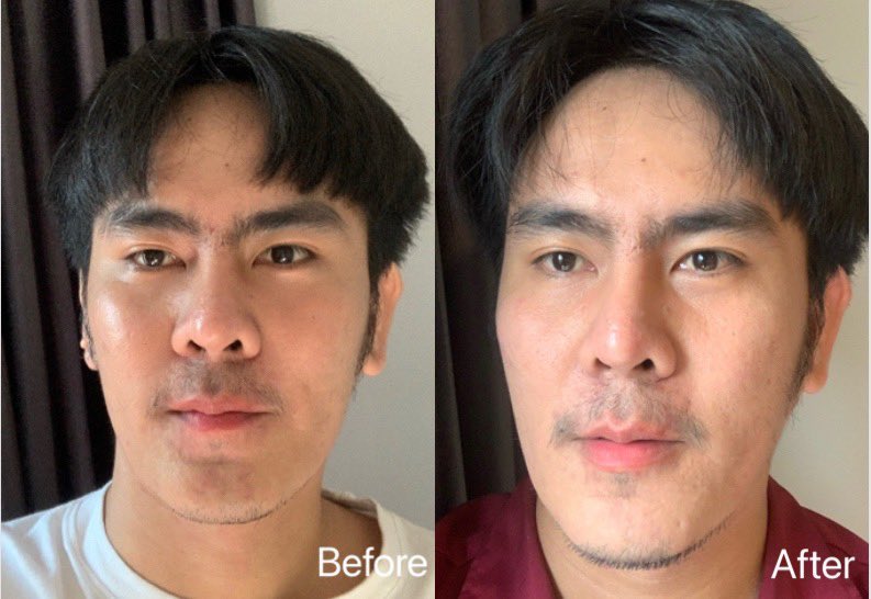 minxoo11's tweet image. มาป้ายยา ครีมซองสูตรใหม่ #Skinsista แบรนด์นี้ใช้ตัวไหนก็ปัง มันดีจริงๆ แบบซองพกพาสะดวก หาซื้อง่าย เป็นทั้งเซรั่มและครีมในซองเดียว ช่วยให้รูขุมขนกระชับ คุมมัน ลดสิวอุดตันด้วย นี่ปลื้มสุด!! คือหลังทาผิวจะเนียนๆขึ้นทันทีเลย คือดีมากก ตามตามไปตำที่ 7-11 ราคา 49.- คุ้มมม 
#ใช้ดีบอกต่อ