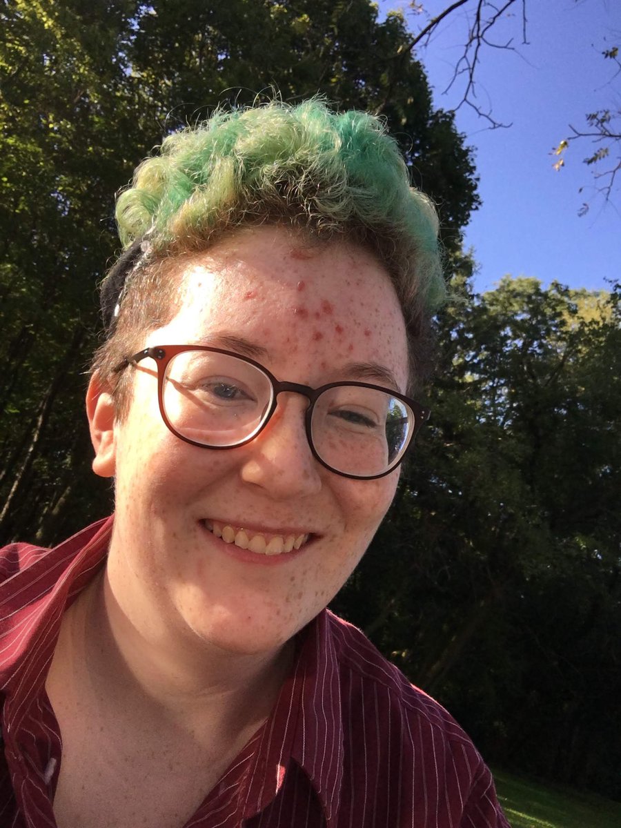 Here are some older pictures of me with dermatillomania scabs. A lot of these have turned into scars. My face is ROUGH. I wish I wasn’t so self conscious about it, because it only heightens my anxiety and furthers the picking.