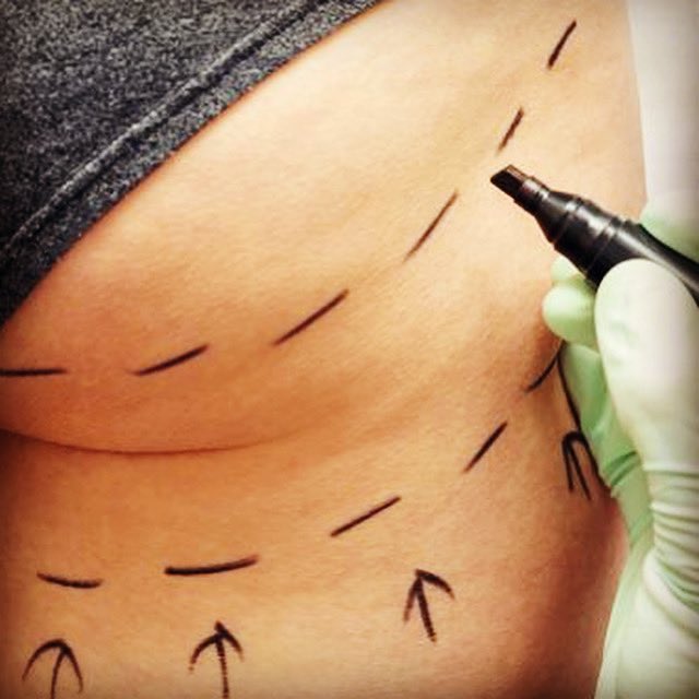 The Aesthetic Society Releases Annual Statistics Revealing Americans Spent Over $9 Billion on Aesthetic Plastic Surgery in 2020
lnkd.in/gMVRPnx
#TheAestheticSociety #Aesthetic #PlasticSurgery #CosmeticMedicine #AestheticPlasticSurgery #AestheticNeuralNetwork