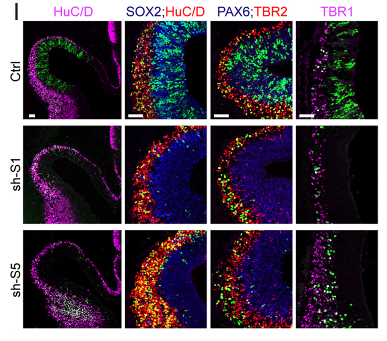 the_Node's tweet photo. #shapinglife2 Gwenvael Le Drรฉau explores the role of SMAD1/5 in controlling RGC self-amplification and cortical growth, in chicks and mice. See the @Dev_journal paper from last year:
https://t.co/ksgdevW4PB https://t.co/NNG70TUiNH