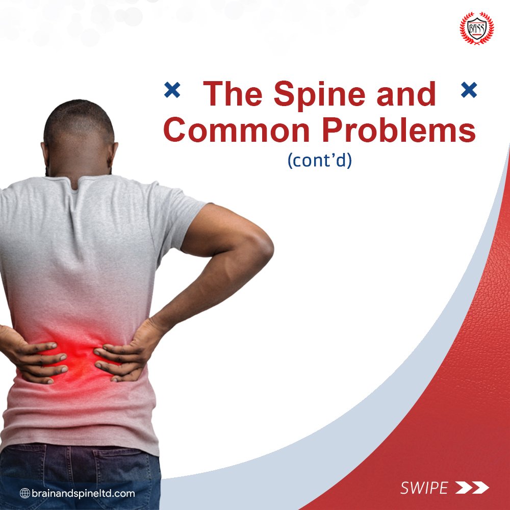 Are you happy you can stand or sit upright?Thank your spine, an important part of the skeletal system.Last week we started the series, "The Spine And Common Problems" and promised to continue today.So Here We Go...