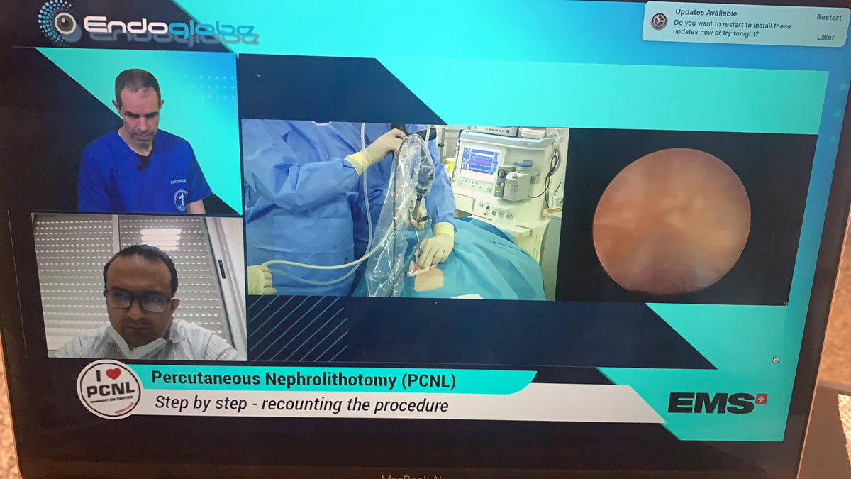 Endoglobe (@endoglobe) on Twitter photo Happening now #livesurgery <a href="/evanliats/">EVANGELOS LIATSIKOS</a> panagiotis kallidonis - supported by <a href="/EMSUrology/">EMS Urology</a> Happening now #livesurgery <a href="/evanliats/">EVANGELOS LIATSIKOS</a> panagiotis kallidonis - supported by <a href="/EMSUrology/">EMS Urology</a>