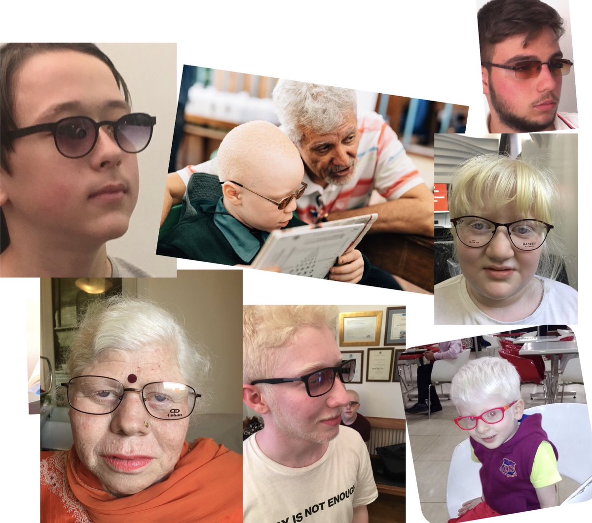 azgorme's tweet photo. This beautiful spectacle is tailor-made for #VisuallyImpaired #LowVision people to make them seeing three times better. Cure your poor vision, disability. You can use this glasses for your every visual need
#ConeDystrophy
#Stargardts
#CRD
#OpticAtrophy
#Myopia
#albinism https://t.co/X13ypfstgY