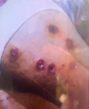 1311revolution's tweet photo. Tw // blood , wound
Around 10:30AM In SanChaung Tsp, Yangon, Myanmar security forces violently crackdown the protest. At least 2 people have been injured by getting shot with rubber bullets. They also forcibly abducted not less than 2 people.
#WhatsHappeningInMyanmar
#Apr9Coup https://t.co/xImyqaEaqp