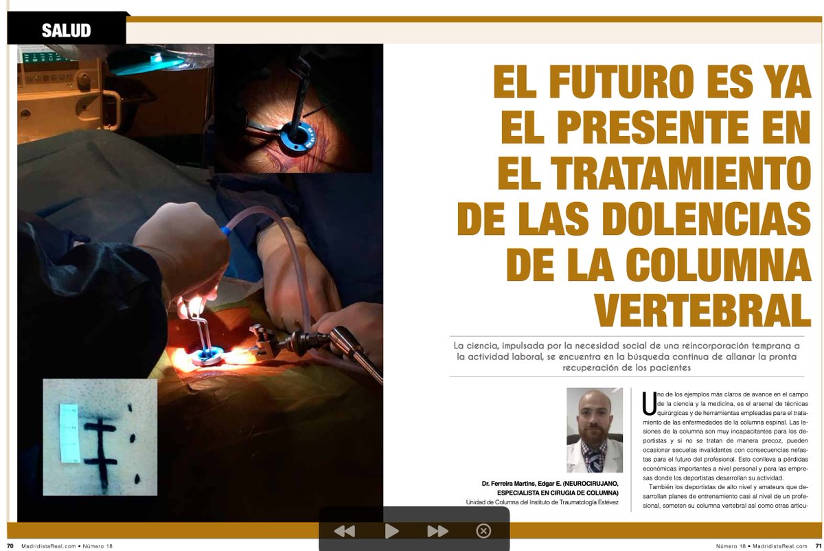 Edgar Ferreira Martins MD Phd #spine tweet media