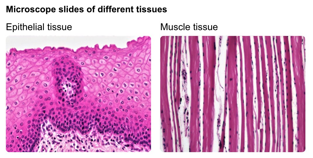 To an early microscopist, the difference between epithelial and muscle tissue would be as clear and striking as it is to any modern student of histology.Its strikingness opens new questions: What's going on here? Why is muscle tissue so ordered? How does it get that way?