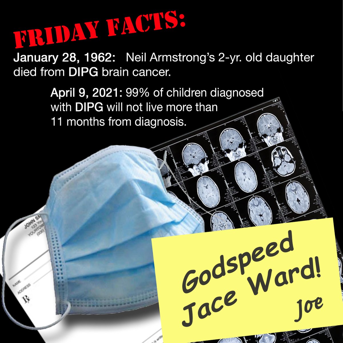 DIPG HISTORY is being made at Stanford today! Jace Ward, has lived 23 mths since diagnosis. Compared to majority of under 10 yr-olds, this 21 yr-old college student is able to communicate EXACT info on his 3rd CAR t-cell tumor infusion #DIPG #ChildhoodCancer <a href="/JaceWard3/">Jace Ward- Tough2gether</a>  GO JACE!