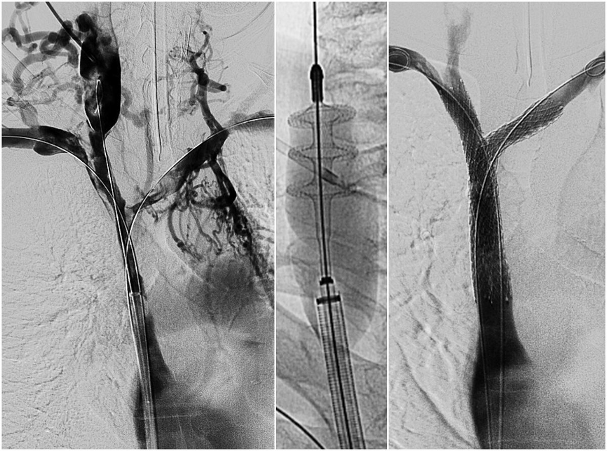 Jeffrey F. B. Chick, MD, MPH tweet media