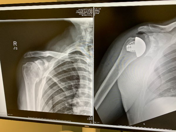 PHASEIV's tweet image. Surf Legend Allen Sarlo is Back in the Waves / Helen Maroulis Wins Olympic Trials / recipe - mailchi.mp/forsterphysica…