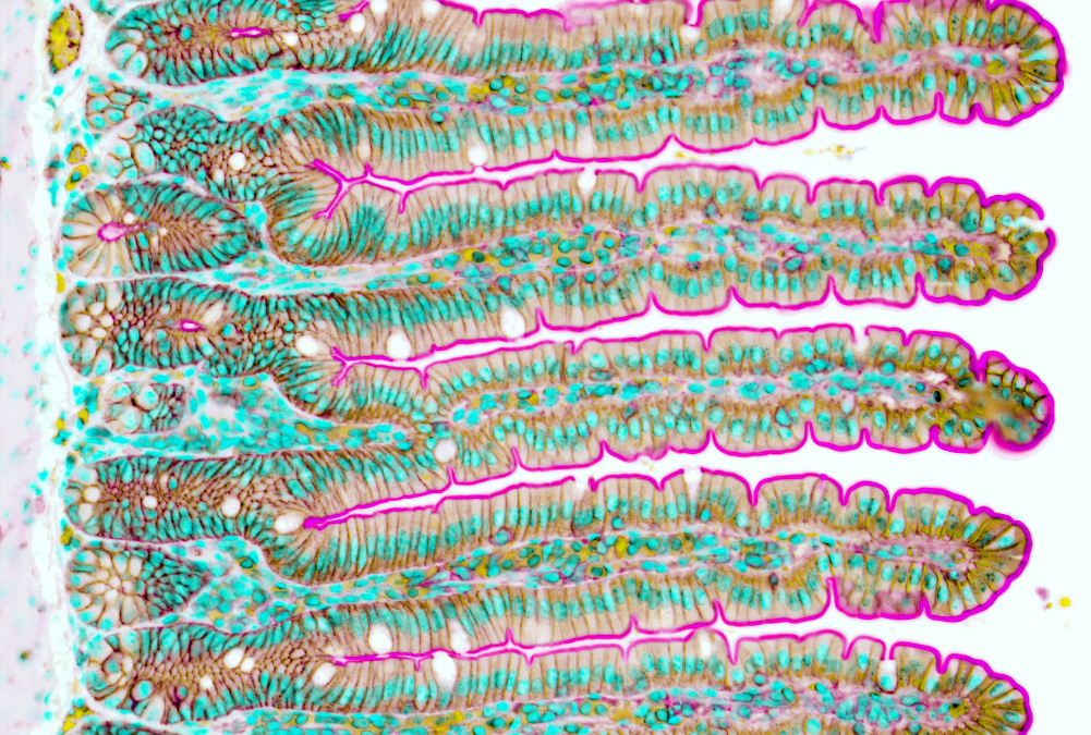 This may be my favorite #FluorescenceFriday yet. #bioart #sciart #sciencetwitter