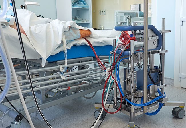 3/ In it’s severest form we can’t physically get enough oxygen into patients to keep them live, so we use a device to infuse oxygen directly into their blood, known as ExtraCorporeal Membrane Oxygenation (ECMO).