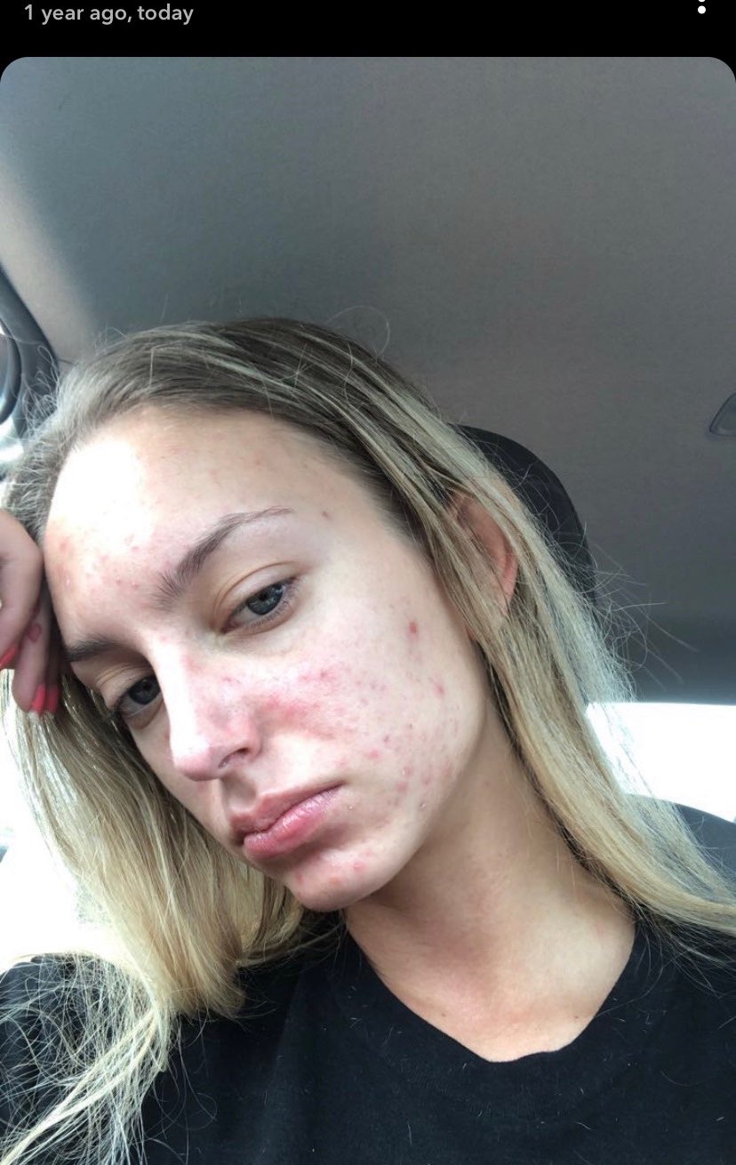 Nut facial cheap