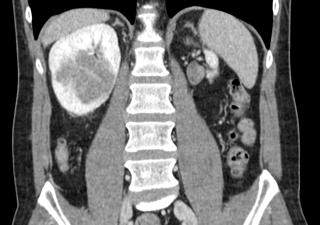 Umberto Capitanio tweet media