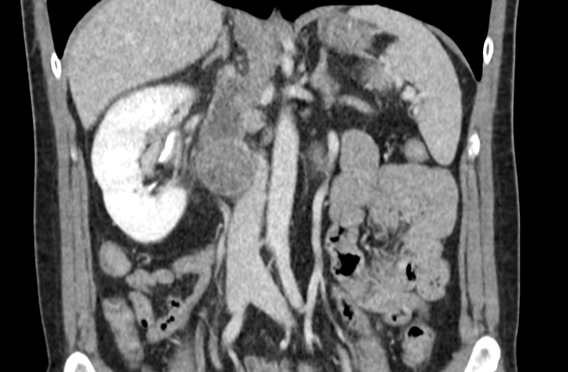 Umberto Capitanio tweet media