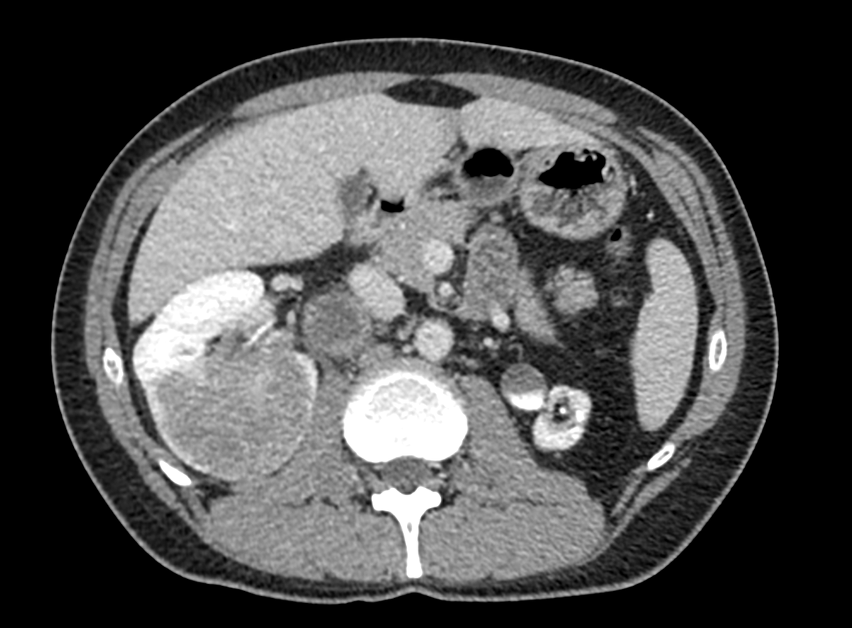 Umberto Capitanio tweet media