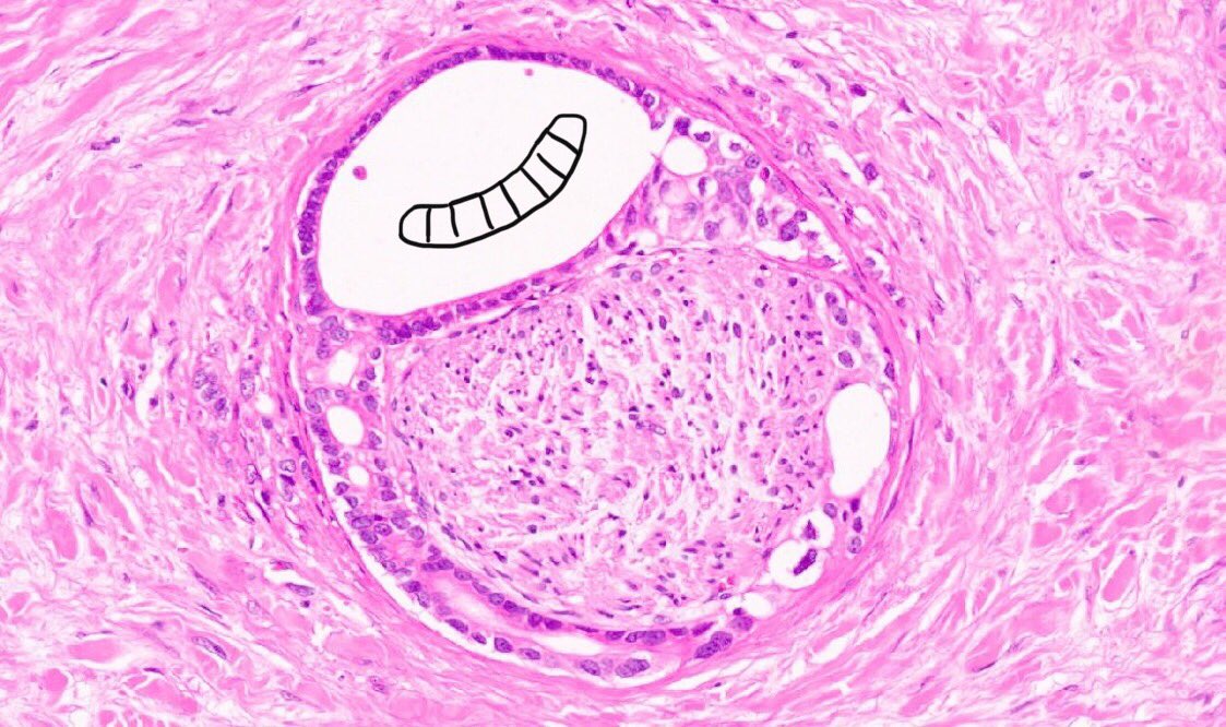 Hezhen Ren tweet media