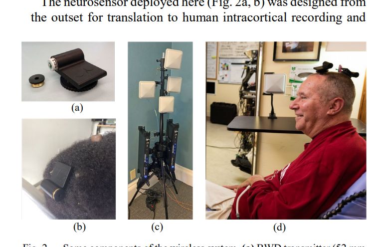 9/ Researchers with the BrainGate consorium, the mainstay of academic BCI research, just published the first demonstration of *wireless* brain control over a cursor by paralyzed *humans.* But you can still see a bunch of electronics screwed onto the skull of the two subjects.