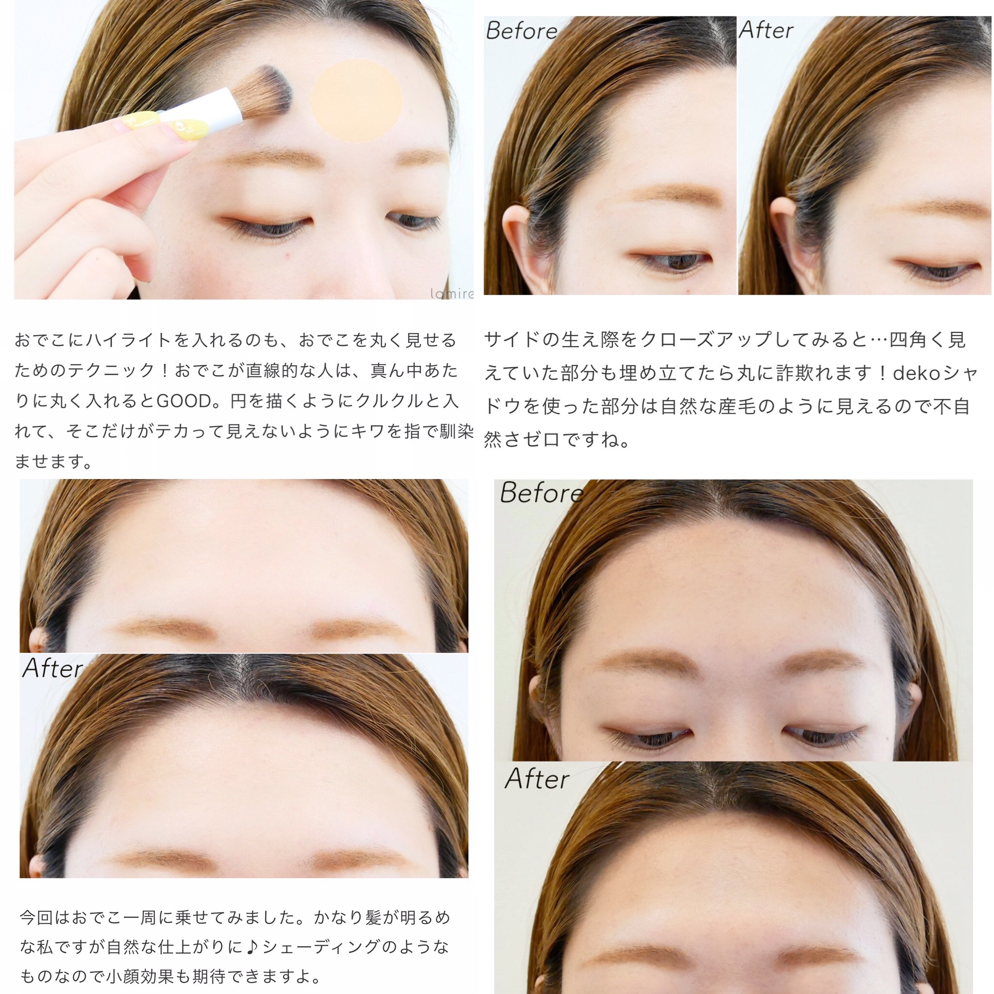 𓂃 室長さん 綺麗なおでこを作る額整形ハイライト 額の中央に丸くいれるとふっくらする 生え際 が四角い人はシャドウで埋める 憧れるのはサナのおでこ 遠目から見てもツヤツヤ華やか そこまで出っ張ってなくても艶があると立体的に見える フィラー