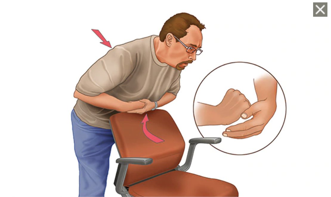 2/ "You can do the Heimlich maneuver on yourself. Use a chair or countertop, press yourself against it (right under your rib cage), and press down hard. Should force air up and dislodge blockage."